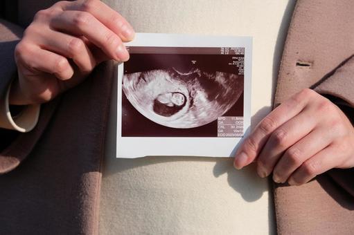 妊婦の1割が選ぶ「出生前診断」とは？身近になったからこそ考えたい命の選択