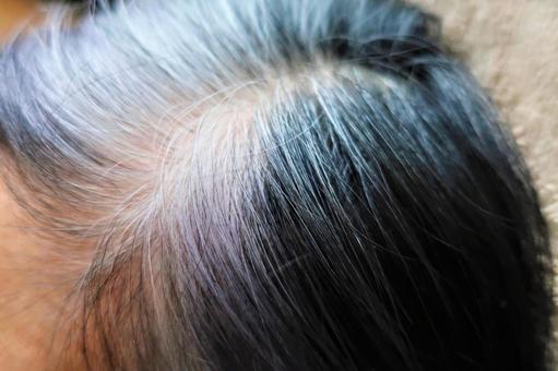 実は「年齢」だけじゃない。白髪が増える本当の原因